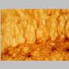 Astroglia GFAP 08.jpg